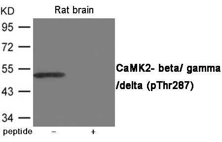CaMK2- beta/ gamma/ delta (Phospho-Thr287) Antibody