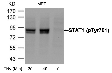STAT1(Phospho-Tyr701) Antibody
