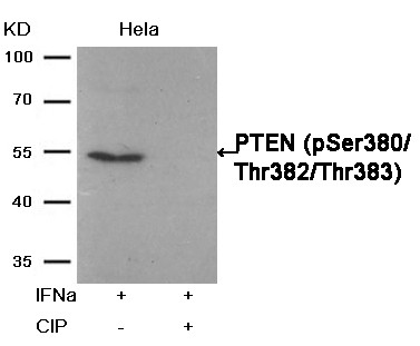 PTEN(Phospho-Ser380/Thr382/Thr383) Antibody