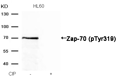 Zap-70(Phospho-Tyr319) Antibody