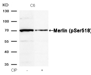 Merlin(Phospho-Ser518) Antibody