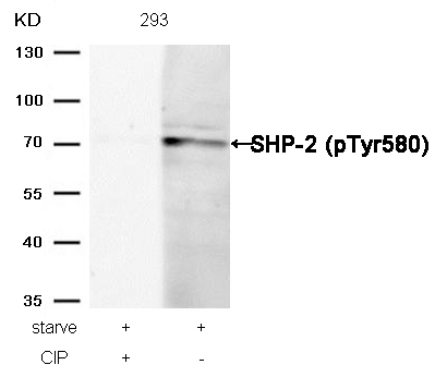 SHP-2(Phospho-Tyr580) Antibody