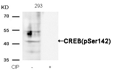 CREB(Phospho-Ser142) Antibody