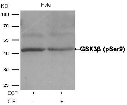 GSK3β(Phospho-Ser9) Antibody