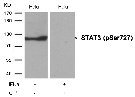 STAT3(Phospho-Ser727) Antibody