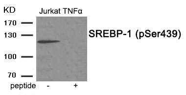 SREBP-1 (Phospho-Ser439) Antibody