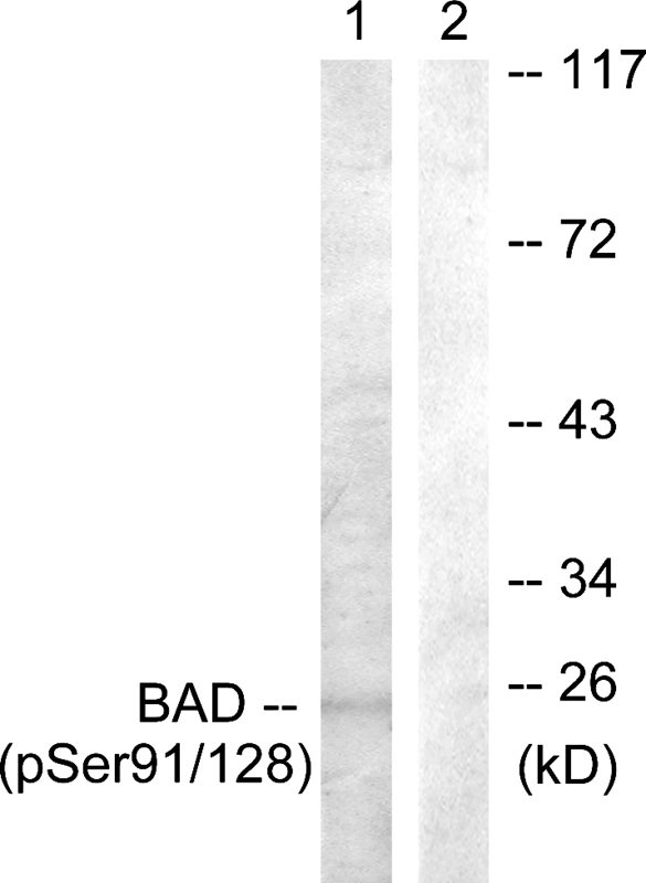 BAD (Phospho-Ser91/128) Antibody