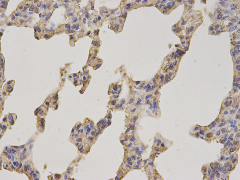 FABP1 Antibody