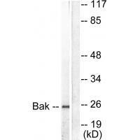 Bak Antibody - SAB | Signalway Antibody