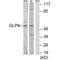 GLPK Antibody 