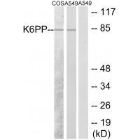K6PP Antibody - SAB | Signalway Antibody