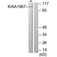 KIAA1967 Antibody 