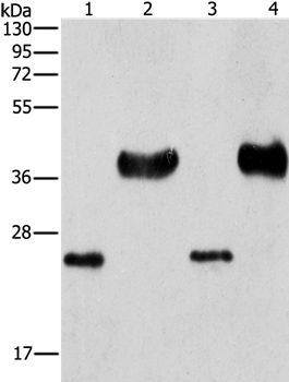 LIN28B  Antibody