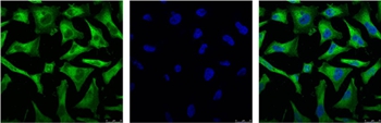 NFκB p65 Mouse Monoclonal Antibody