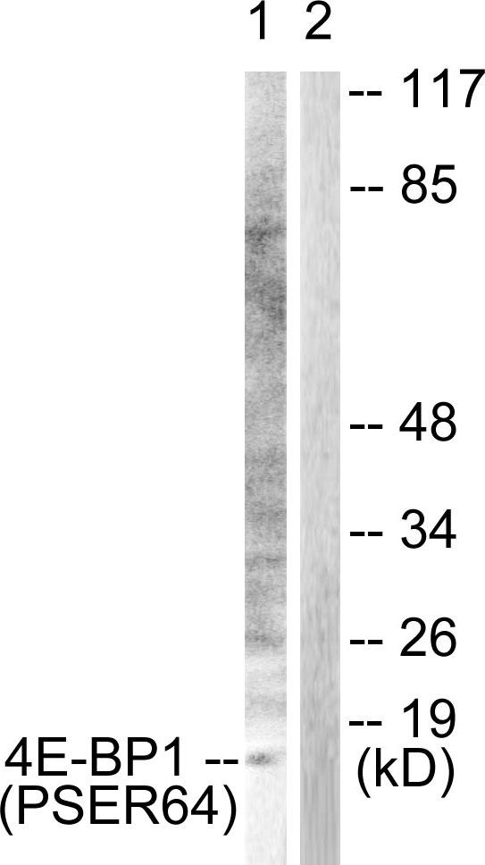 4E-BP1 (Phospho-Ser65) Antibody