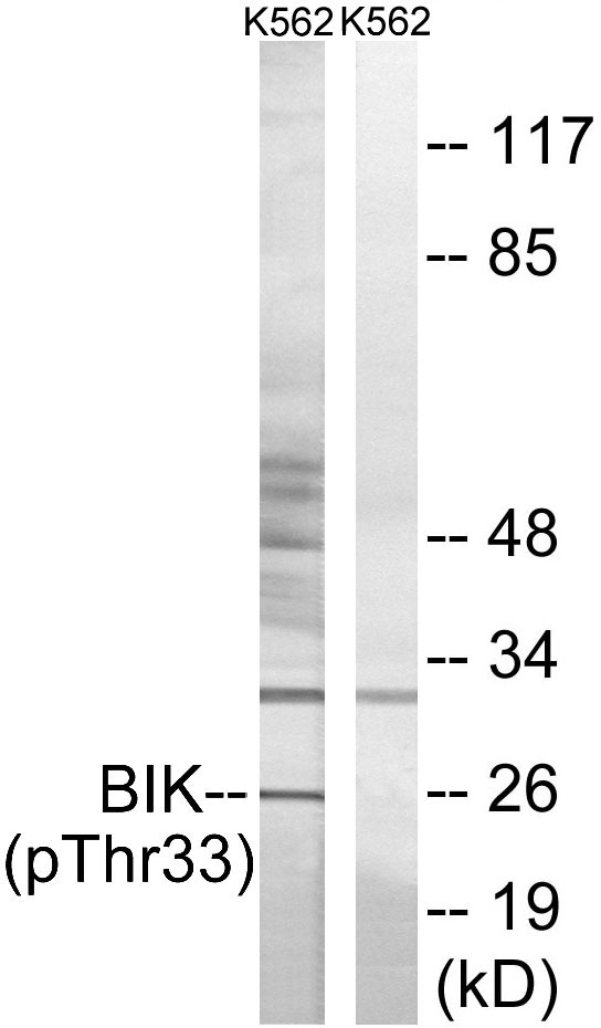 BIK (Phospho-Thr33) Antibody