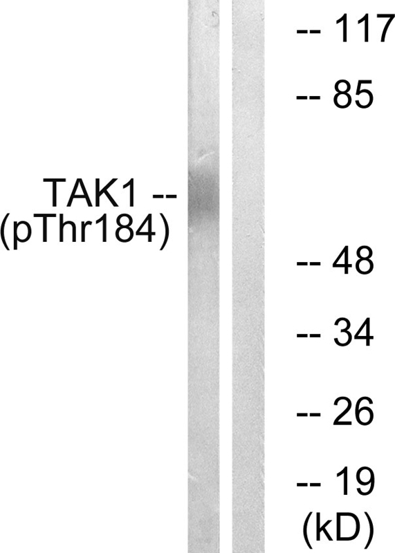 TAK1 (Phospho-Thr184) Antibody