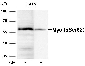 Myc(Phospho-Ser62) Antibody