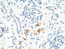 Kif 7 Monoclonal Antibody