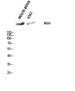 Atm Polyclonal Antibody