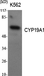 CYP19A1 Polyclonal Antibody