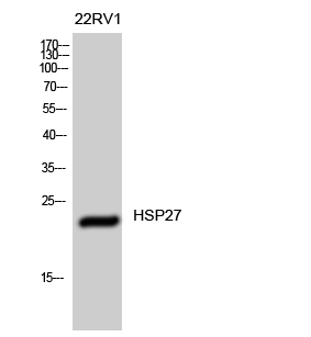 HSP27 Polyclonal Antibody
