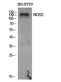 NOS2 Polyclonal Antibody