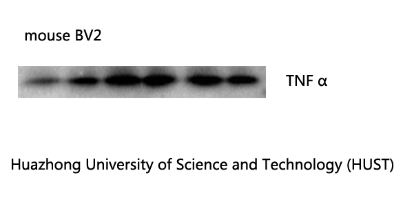 TNF α Monoclonal antibody(Q34)