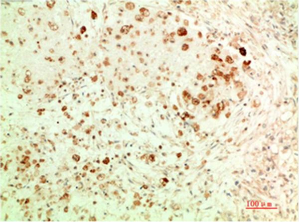 ATG5 Mouse Monoclonal Antibody(3C7)