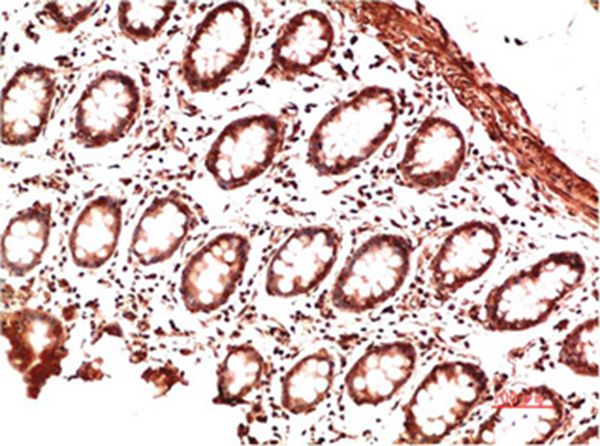Collagen II Mouse Monoclonal Antibody(9F11)