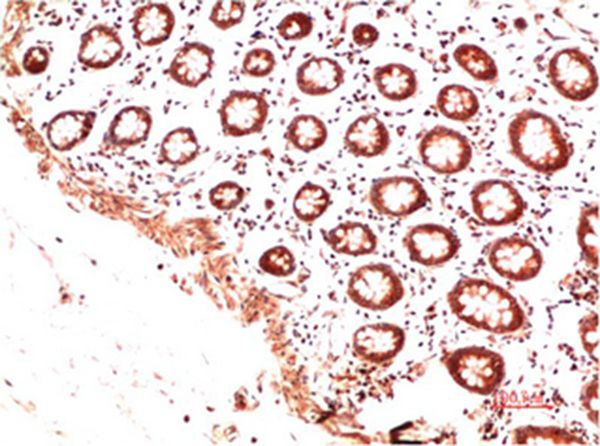 Collagen II Mouse Monoclonal Antibody(9C5)