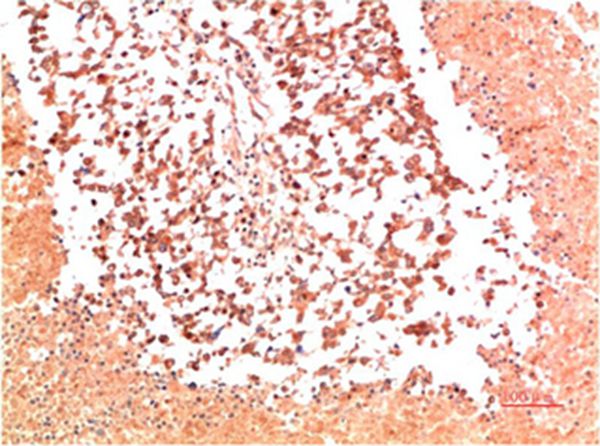 Collagen II Mouse Monoclonal Antibody(9C5)