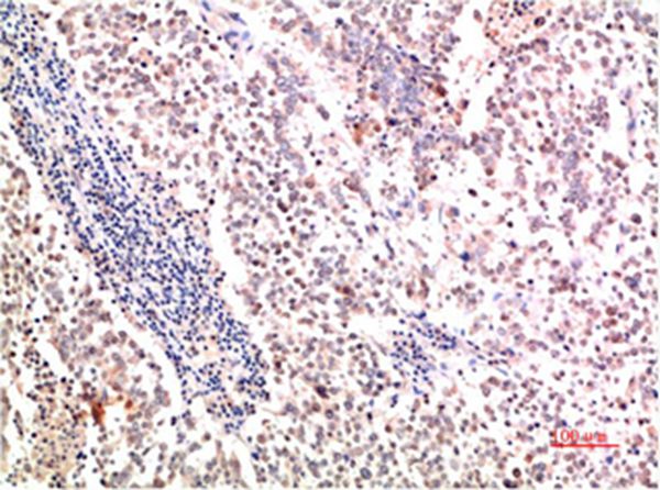Collagen II Mouse Monoclonal Antibody(7F9) 
