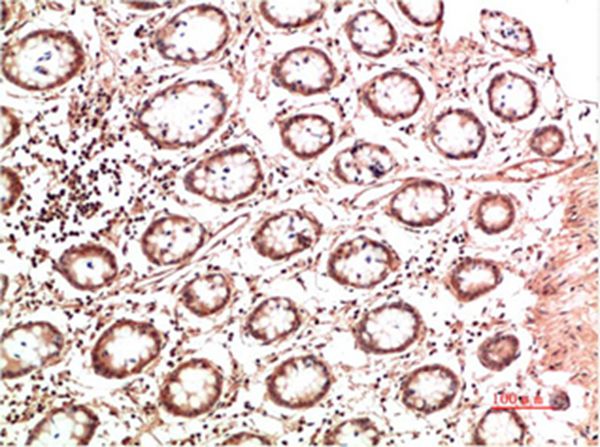 Collagen II Mouse Monoclonal Antibody(7F9) 