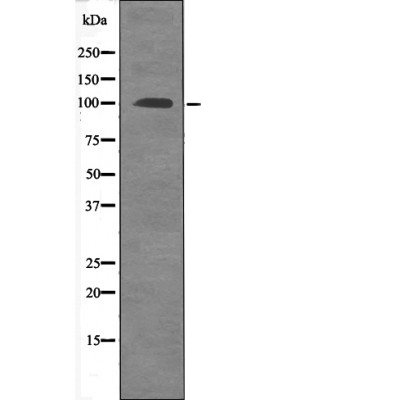 FKHRL1 (Phospho-Ser315) Antibody