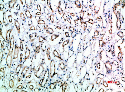 CD151 Polyclonal Antibody