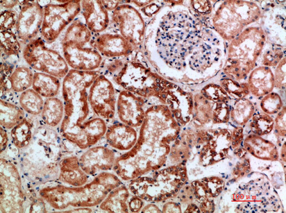BTN3A1/2/3 Polyclonal Antibody