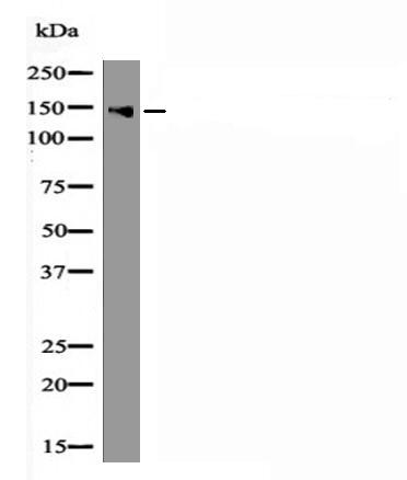 LATS2 (Phospho-Ser872) Antibody