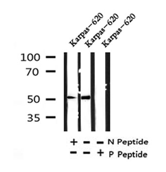 IRF4(Phospho-Tyr122/125) antibody