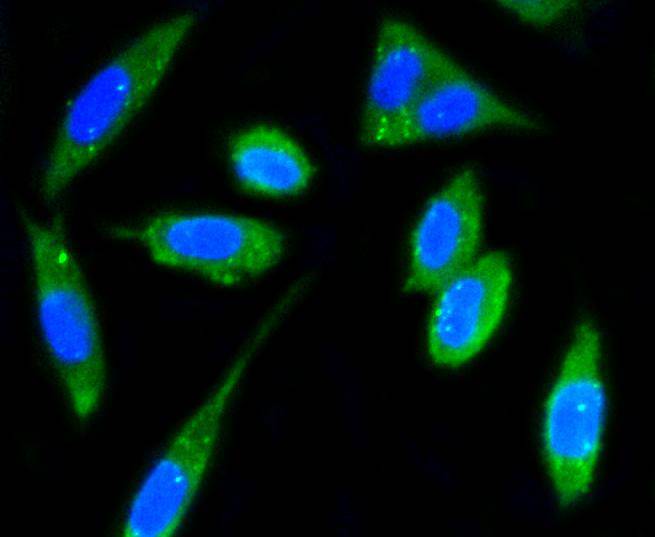 FAK Rabbit mAb - SAB | Signalway Antibody