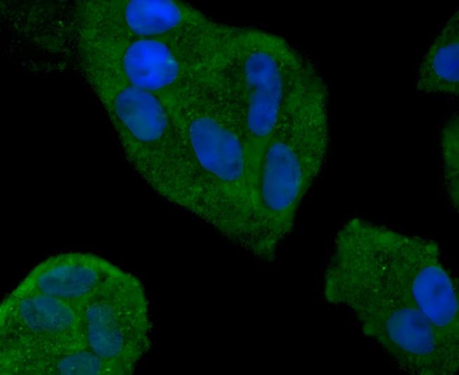 Smad4 Rabbit mAb - SAB | Signalway Antibody