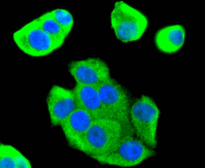 FOXO1 Rabbit mAb - SAB | Signalway Antibody