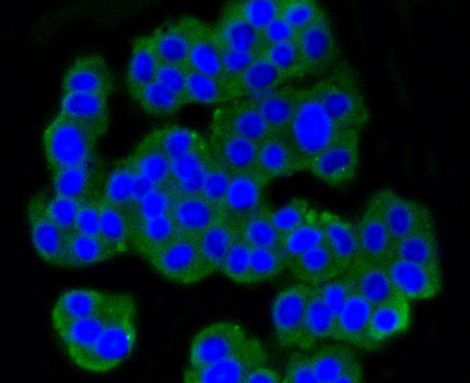 Metabotropic glutamate receptor 5 Rabbit mAb - SAB | Signalway Antibody