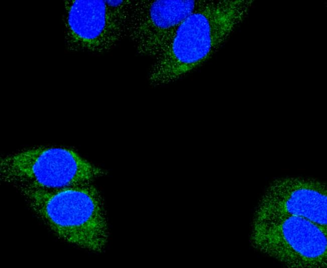 Glutaminase Rabbit mAb - SAB | Signalway Antibody
