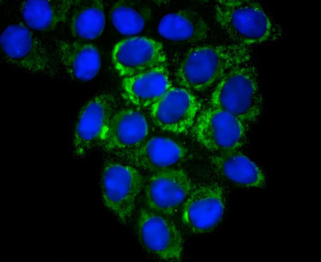 Glutaminase Rabbit mAb - SAB | Signalway Antibody