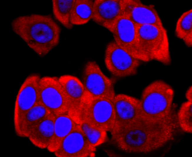 FGFR3 Rabbit mAb - SAB | Signalway Antibody