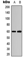 AKT1/2 (phospho-Thr308/309) Antibody