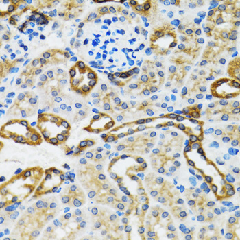 Caspase3 Polyclonal Antibody