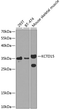 KCTD15 Polyclonal Antibody