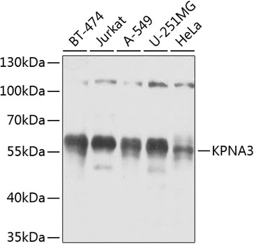 KPNA3 Polyclonal Antibody